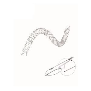 stent ureterale