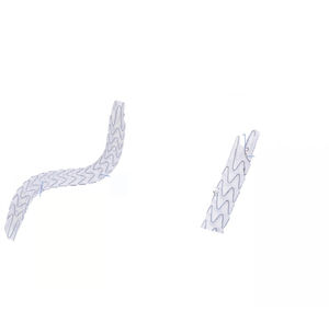 stent ureterale