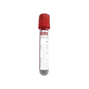 provetta per prelievi per analisi su plasma 1