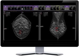 piattaforma AI per ospedali