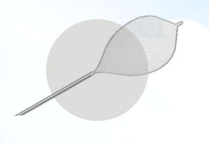 cestello endoscopico per estrazione di polipi intestinali 1