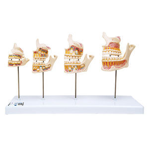 modello anatomico di denti