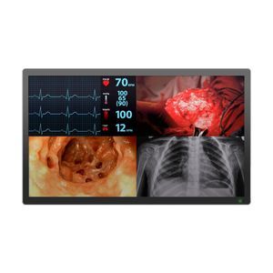 monitor medico