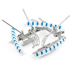 divaricatore cardiaco 1