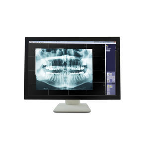 monitor medico 1