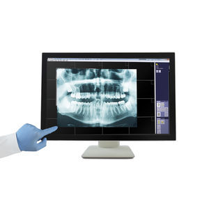 monitor medico 1