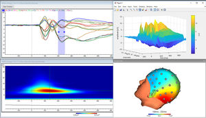 software per EEG
