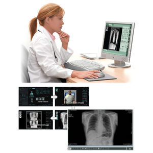 sistema di acquisizione per radiografia 1