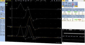 software per EMG 1