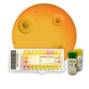 kit di test di suscettibilità antimicrobica