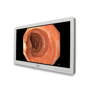 monitor diagnostico