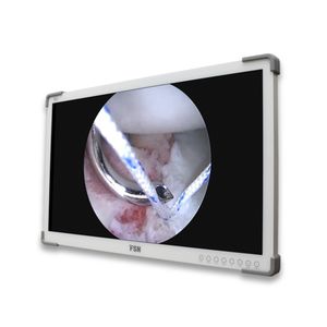 monitor medico 1