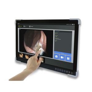 monitor per endoscopia 1