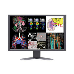 software di visualizzazione