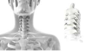 gabbia intersomatica cervicale