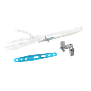 placca di compressione per ulna