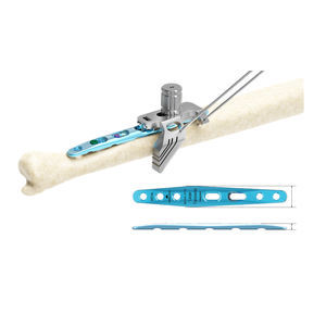 placca per osteotomia per ulna 1