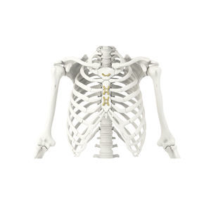 placca di compressione per sterno 1
