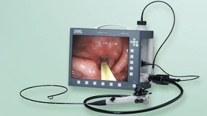 gastroscopio veterinario video