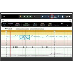 simulatore per monitor fetali 1