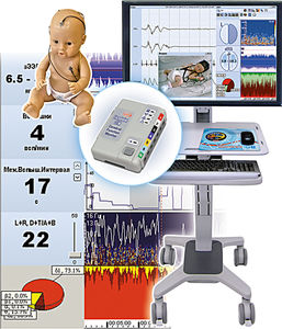 monitor paziente EEG