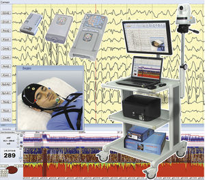monitor RESP per paziente