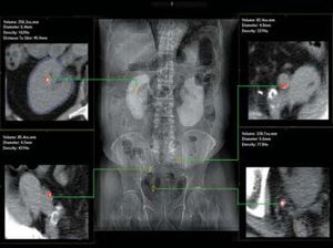 software per ospedale