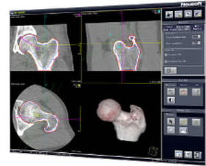 software per ospedale