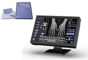 sistema di acquisizione per radiografia