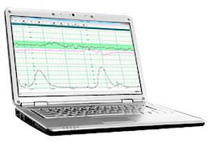 software di analisi