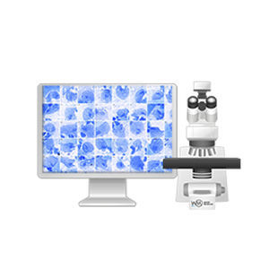 sistema di imaging cellulare automatico