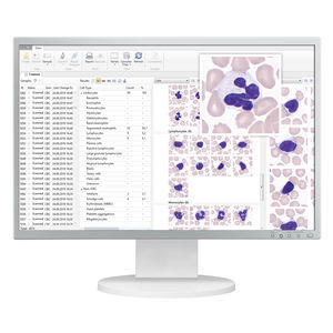 sistema di imaging cellulare automatico