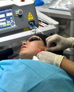 unità di ringiovanimento cutaneo laser 1