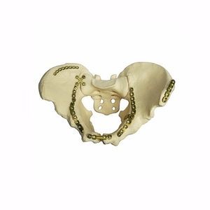 placca di compressione per bacino