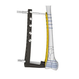 placca per osteotomia femorale 1