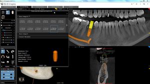 software per chirurgia odontoiatrica