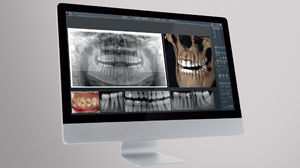 software per imaging odontoiatrico