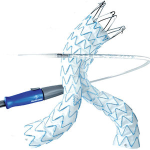 innesto stent aorta addominale / in poliestere