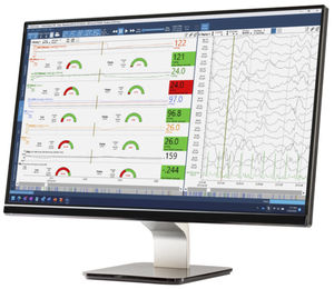 software di analisi