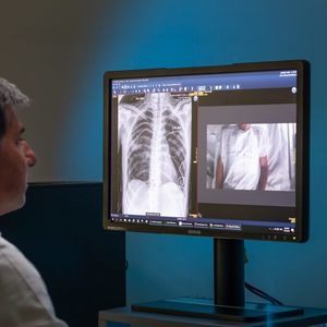 software per radiologia