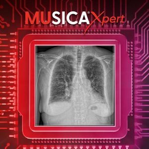 sistema di post trattamento per il settore medico 1