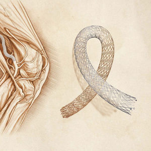 stent periferico / in nitinol / autoespandibile