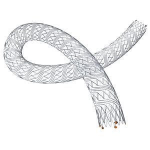 stent periferico 1