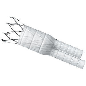 innesto stent aorta addominale