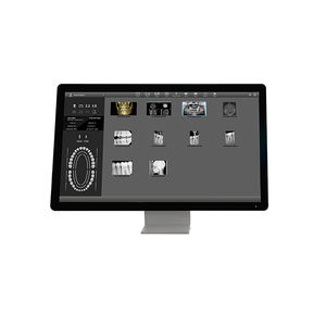 software per imaging odontoiatrico