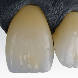 materiale odontoiatrico in zircone / CAD CAM / ad altissima translucenza / bianco