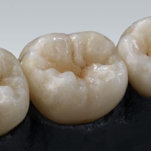materiale odontoiatrico in zircone / CAD CAM / per corone dentali / per faccette dentali