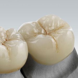 materiale odontoiatrico in ceramica di vetro / per restauro dentale / CAD CAM / per corone dentali