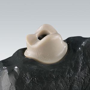 materiale odontoiatrico in polimero acrilico / CAD CAM / per corone dentali / per ponti dentali