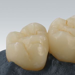 materiale odontoiatrico in ceramica ibrida / per corone dentali
